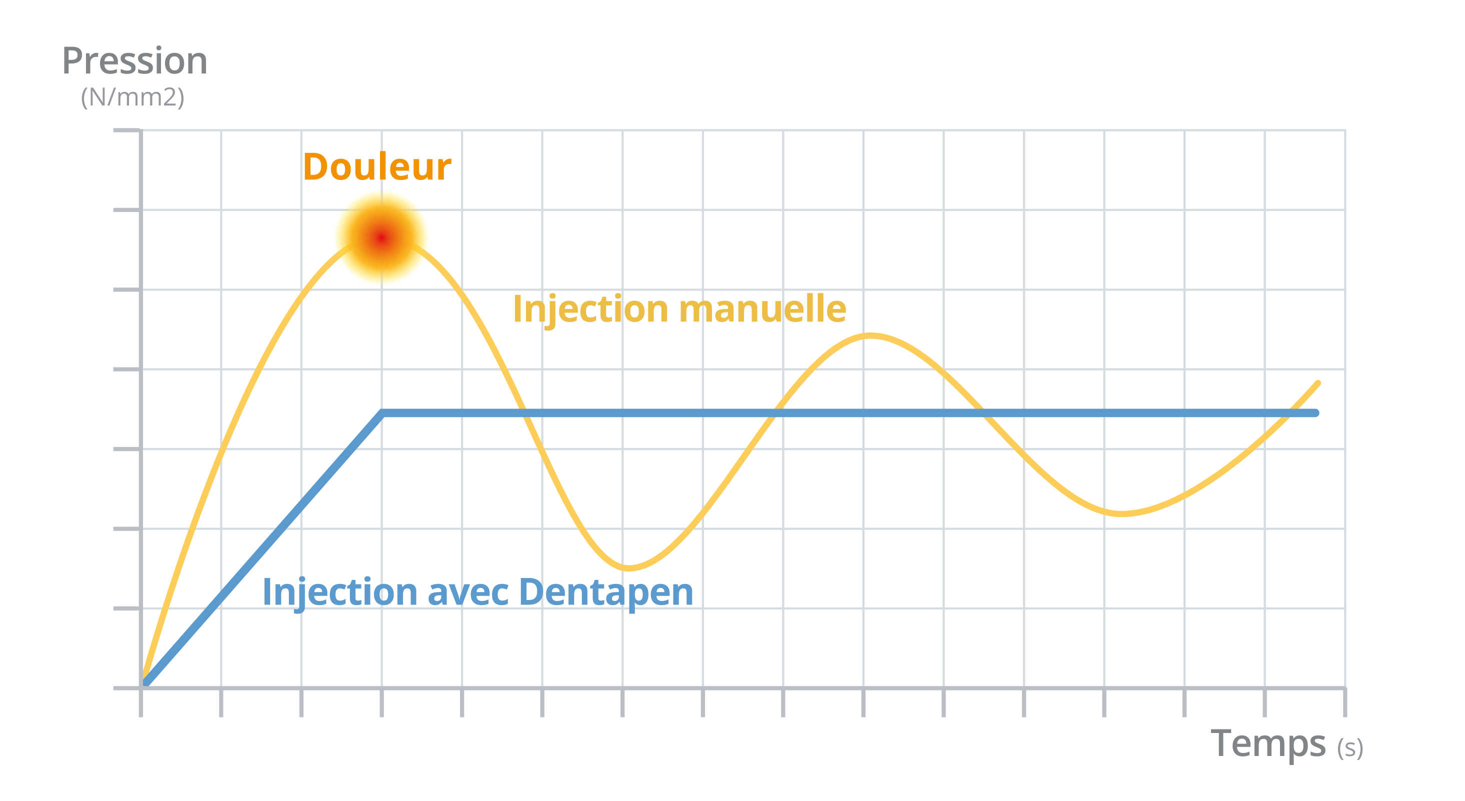 Dentapen PainReduction Graph FRENCH Sans fond