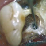 Endodontie