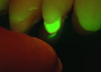 Fluo 4