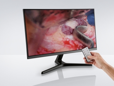 Options flexibles d'acquisition et de visualisation des images