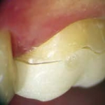 Prosthodontie & esthétique
