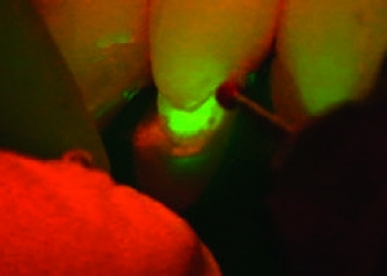 Fluo 5