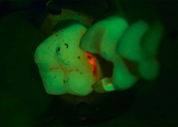 Fluo 1