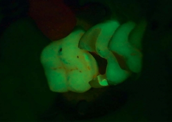 FluorescenceModeApres
